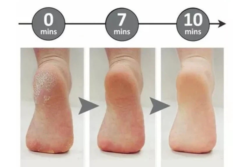 VelvetFeet - Lima eléctrica quita callos